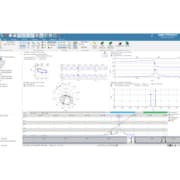 maintenance prédictive avec le logiciel CMS SETPOINT